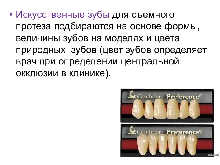 Искусственные зубы для съемного протеза подбираются на основе формы, величины зубов на