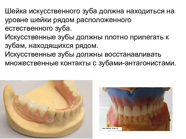 Шейка искусственного зуба должна находиться на уровне шейки рядом расположенного естественного зуба.
