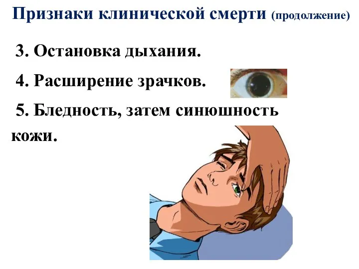 Признаки клинической смерти (продолжение) 3. Остановка дыхания. 4. Расширение зрачков. 5. Бледность, затем синюшность кожи.