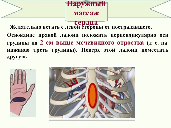 Желательно встать с левой стороны от пострадавшего. Основание правой ладони положить перпендикулярно