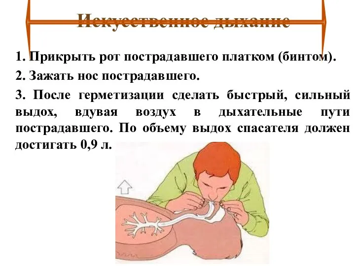 Искусственное дыхание 1. Прикрыть рот пострадавшего платком (бинтом). 2. Зажать нос пострадавшего.