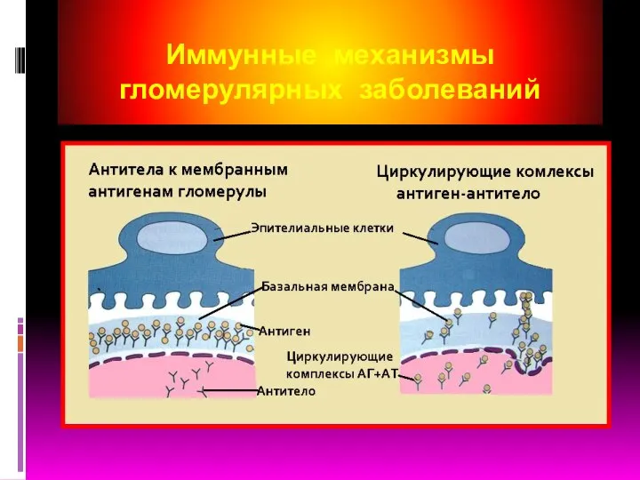 Иммунные механизмы гломерулярных заболеваний