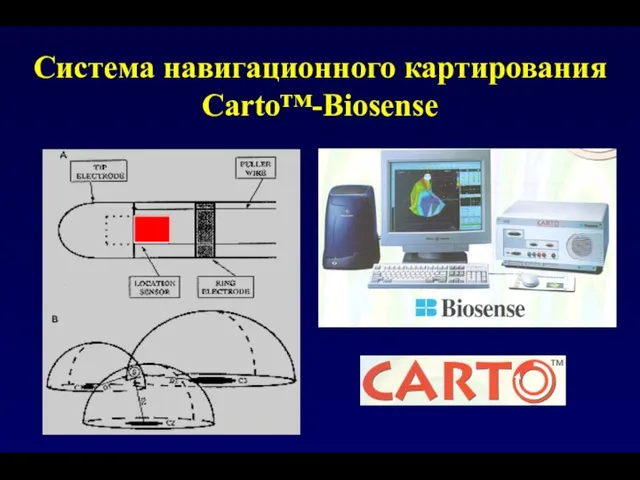 Система навигационного картирования Carto™-Biosense