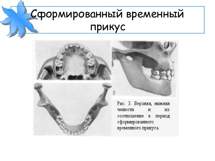 Сформированный временный прикус