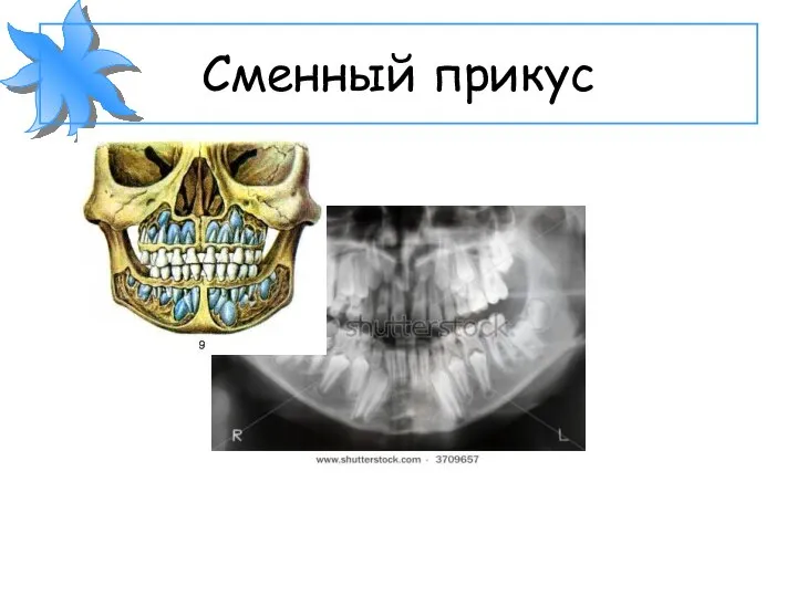 Сменный прикус