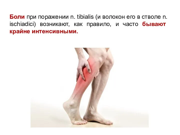 Боли при поражении n. tibialis (и волокон его в стволе n. ischiadici)