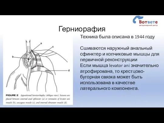 Герниорафия Техника была описана в 1944 году Сшиваются наружный анальный сфинктер и