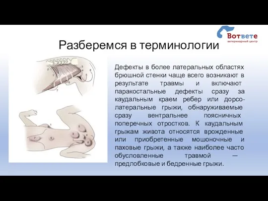 Разберемся в терминологии Дефекты в более латеральных областях брюшной стенки чаще всего