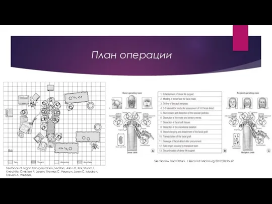 План операции Siemionow and Ozturk. J Reconstr Microsurg 2012;28:35-42 Textbook of organ