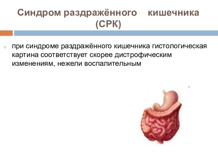 при синдроме раздражённого кишечника гистологическая картина соответствует скорее дистрофическим изменениям, нежели воспалительным Синдром раздражённого кишечника (СРК)