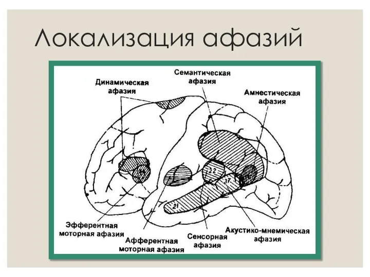 Локализация афазий