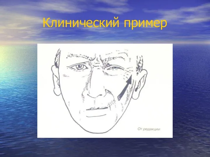 Клинический пример