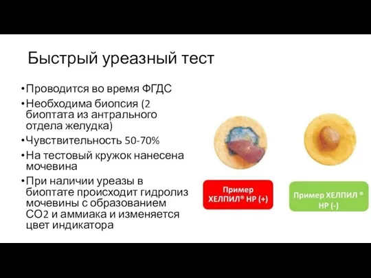 Быстрый уреазный тест Проводится во время ФГДС Необходима биопсия (2 биоптата из