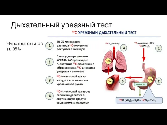 Дыхательный уреазный тест Чувствительность 95%