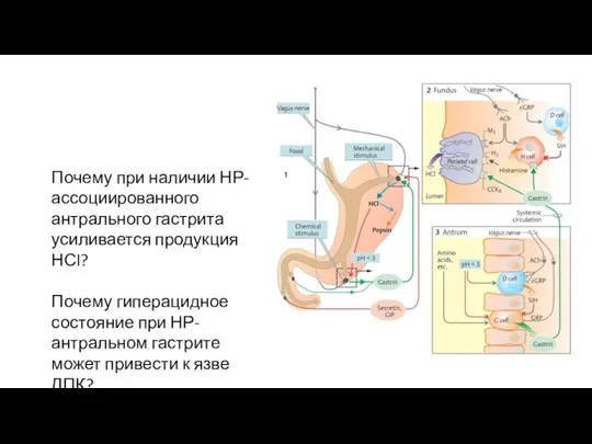 Почему при наличии НР-ассоциированного антрального гастрита усиливается продукция НСl? Почему гиперацидное состояние