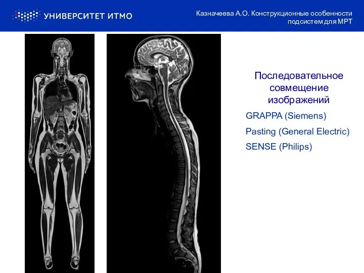 Последовательное совмещение изображений GRAPPA (Siemens) Pasting (General Electric) SENSE (Philips) Казначеева А.О.