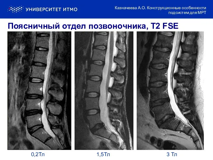 0,2Тл 1,5Тл 3 Тл Поясничный отдел позвоночника, T2 FSE Казначеева А.О. Конструкционные особенности подсистем для МРТ