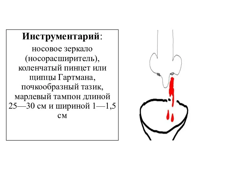 Инструментарий: носовое зеркало (носорасширитель), коленчатый пинцет или щипцы Гартмана, почкообразный тазик, марлевый