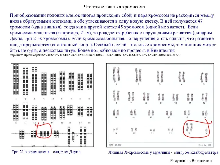 Что такое лишняя хромосома При образовании половых клеток иногда происходит сбой, и