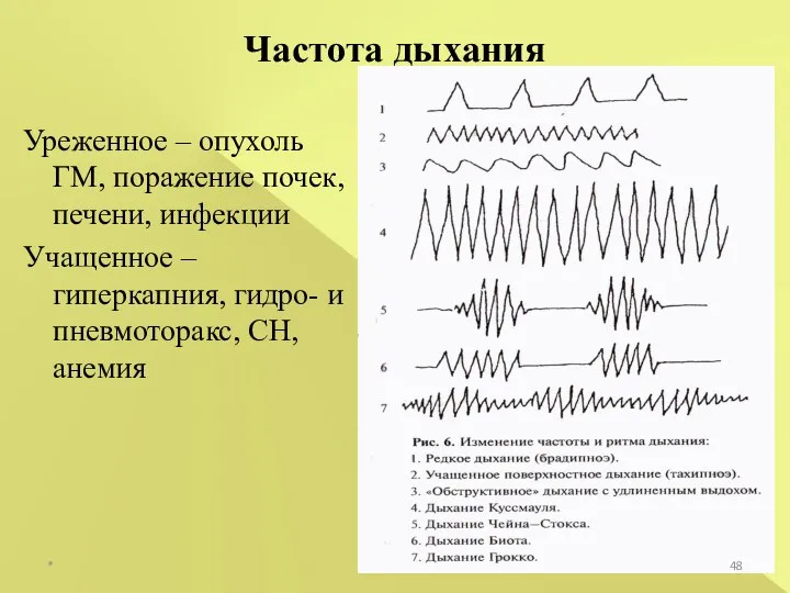 * Частота дыхания Уреженное – опухоль ГМ, поражение почек, печени, инфекции Учащенное