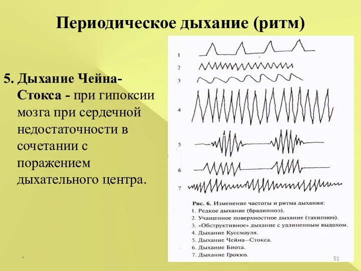 * Периодическое дыхание (ритм) 5. Дыхание Чейна-Стокса - при гипоксии мозга при