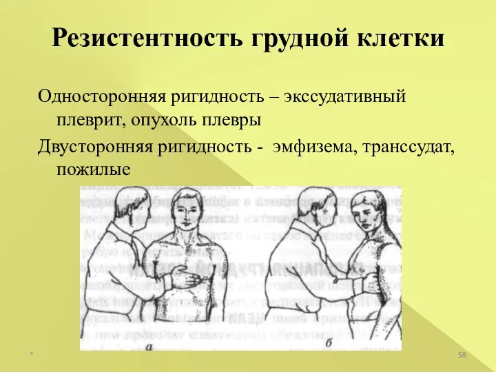 Односторонняя ригидность – экссудативный плеврит, опухоль плевры Двусторонняя ригидность - эмфизема, транссудат,