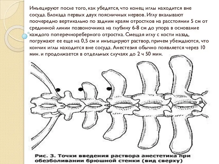 Инъецируют после того, как убедятся, что конец иглы находится вне сосуда. Блокада