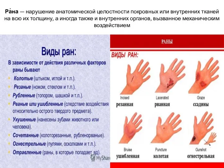 Ра́на — нарушение анатомической целостности покровных или внутренних тканей на всю их