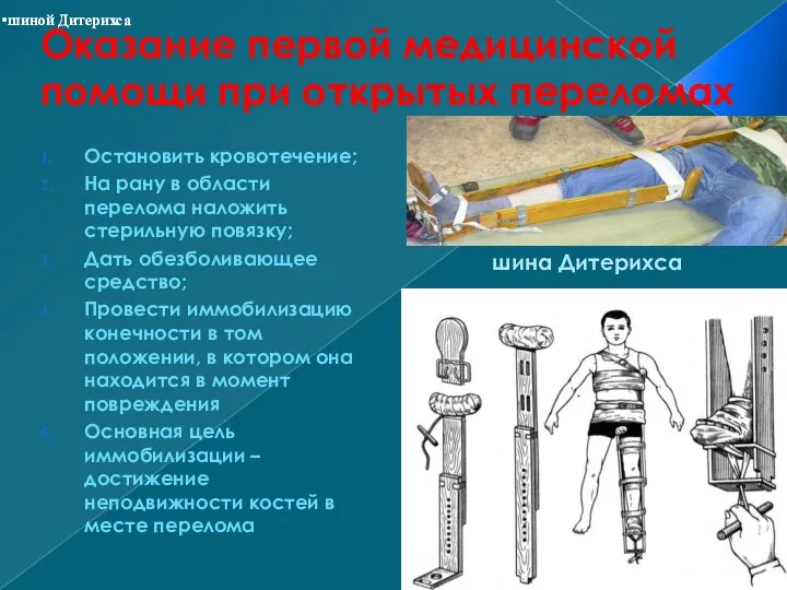 Оказание первой медицинской помощи при открытых переломах Остановить кровотечение; На рану в