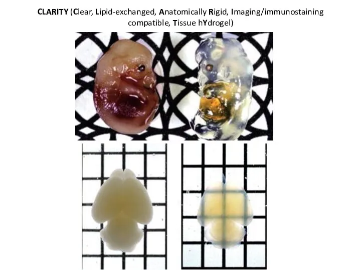 CLARITY (Clear, Lipid-exchanged, Anatomically Rigid, Imaging/immunostaining compatible, Tissue hYdrogel)