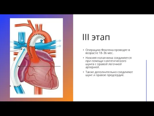 III этап Операцию Фонтена проводят в возрасте 18–36 мес. Нижняя полая вена