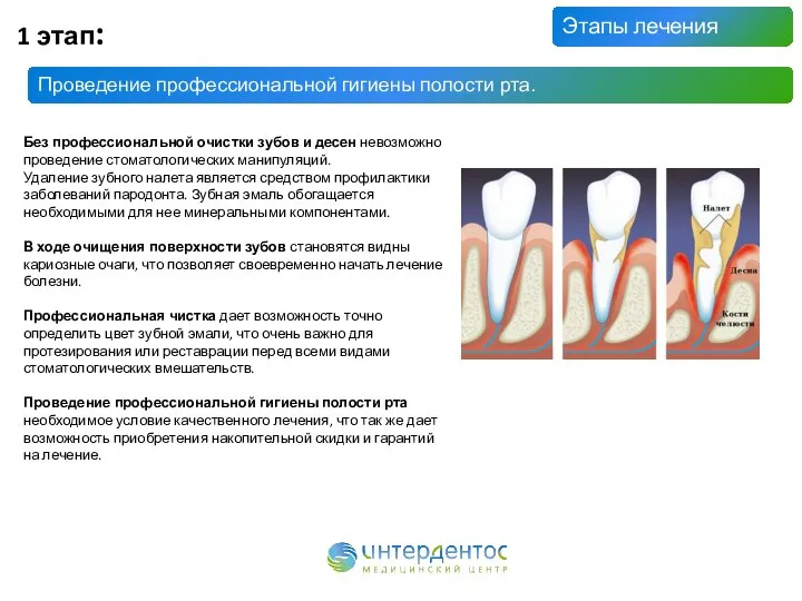 Без профессиональной очистки зубов и десен невозможно проведение стоматологических манипуляций. Удаление зубного