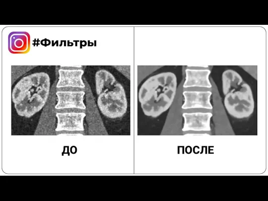 #Фильтры ДО ПОСЛЕ