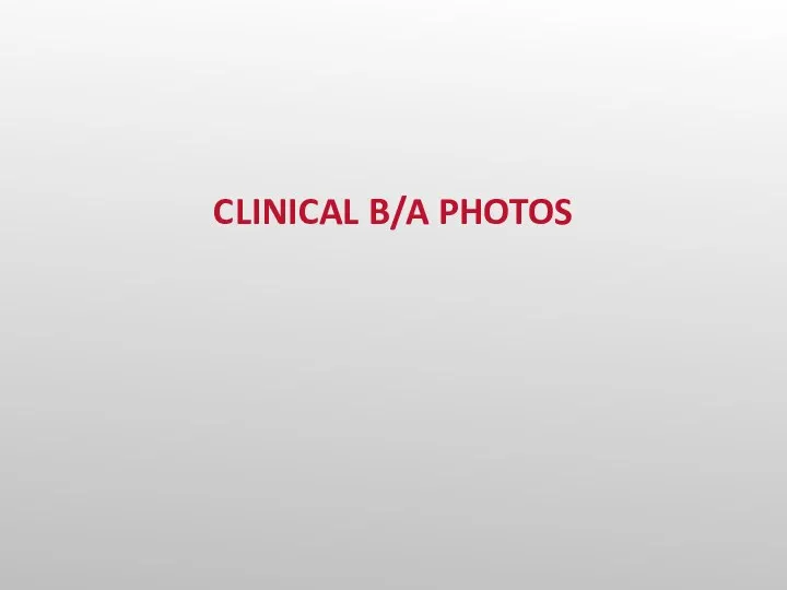 CLINICAL B/A PHOTOS