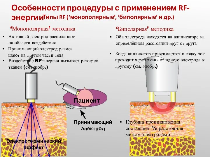 Типы RF (‘монополярные’, ‘биполярные’ и др.) ‘Монополярная’ методика ‘Биполярная’ методика Активный электрод