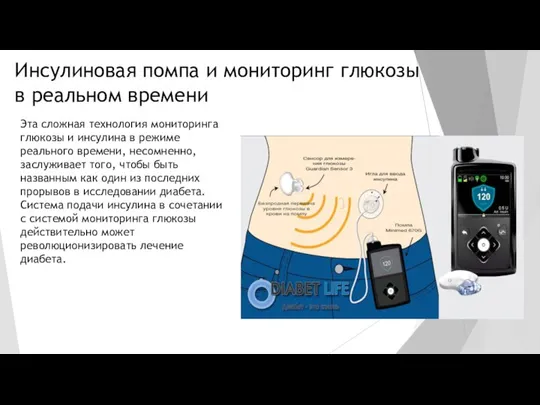 Инсулиновая помпа и мониторинг глюкозы в реальном времени Эта сложная технология мониторинга