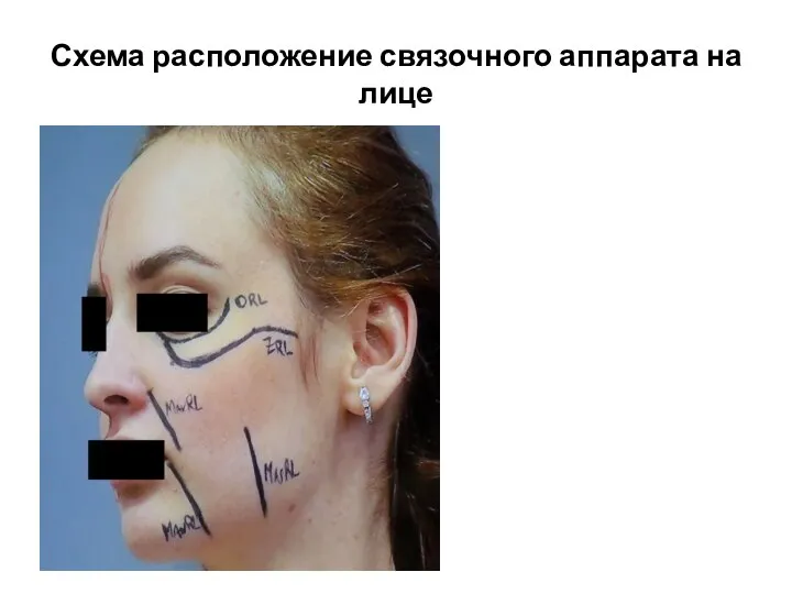 Схема расположение связочного аппарата на лице