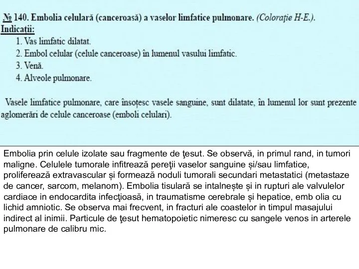 Embolia prin celule izolate sau fragmente de ţesut. Se observă, in primul