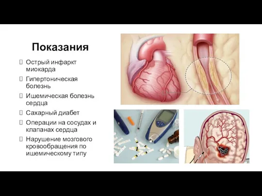 Показания Острый инфаркт миокарда Гипертоническая болезнь Ишемическая болезнь сердца Сахарный диабет Операции