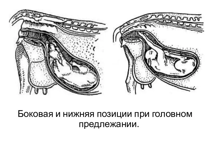 Боковая и нижняя позиции при головном предлежании.