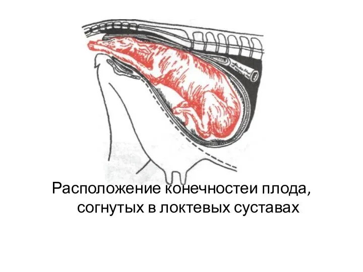 Расположение конечностей плода, согнутых в локтевых суставах