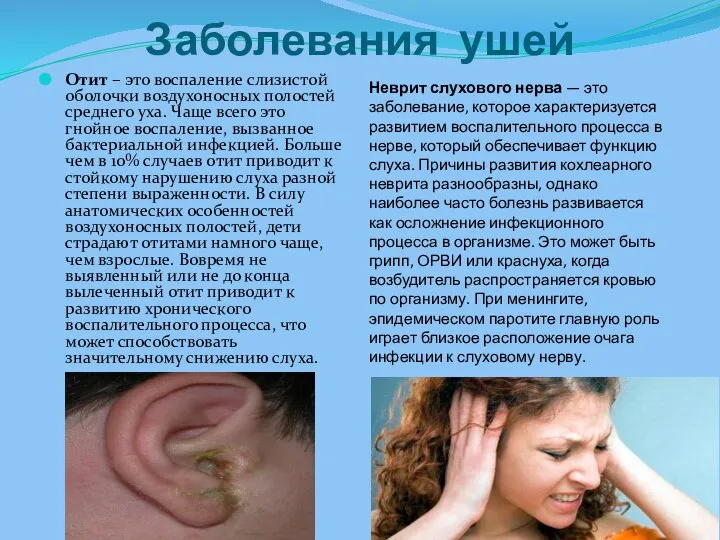 Заболевания ушей Неврит слухового нерва — это заболевание, которое характеризуется развитием воспалительного