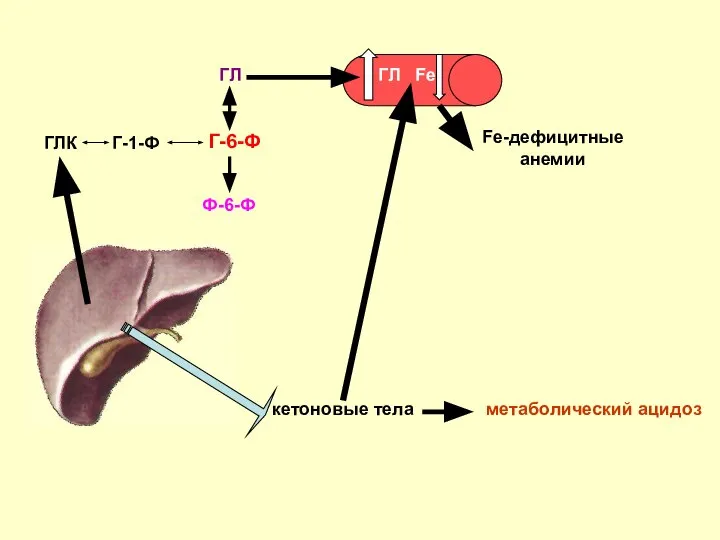 ГЛК Г-1-Ф Г-6-Ф Ф-6-Ф ГЛ ГЛ кетоновые тела Fe метаболический ацидоз Fe-дефицитные анемии
