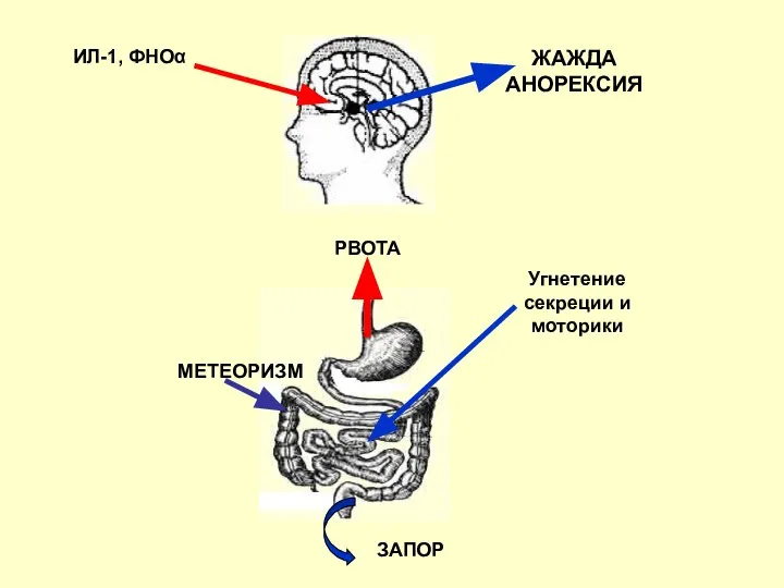 Угнетение секреции и моторики РВОТА ИЛ-1, ФНОα ЖАЖДА АНОРЕКСИЯ МЕТЕОРИЗМ ЗАПОР