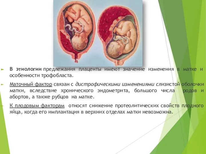 В этиологии предлежания плаценты имеют значение изменения в матке и особенности трофобласта.