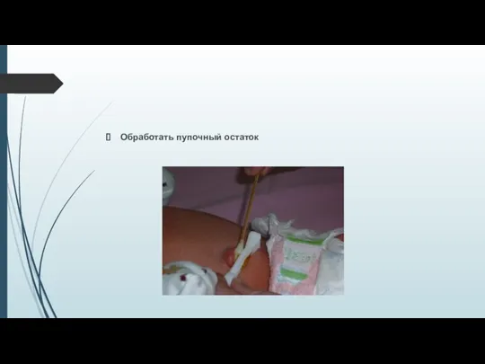 Обработать пупочный остаток