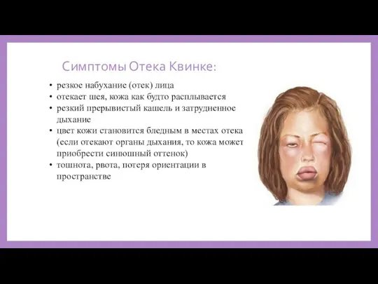 Симптомы Отека Квинке: резкое набухание (отек) лица отекает шея, кожа как будто