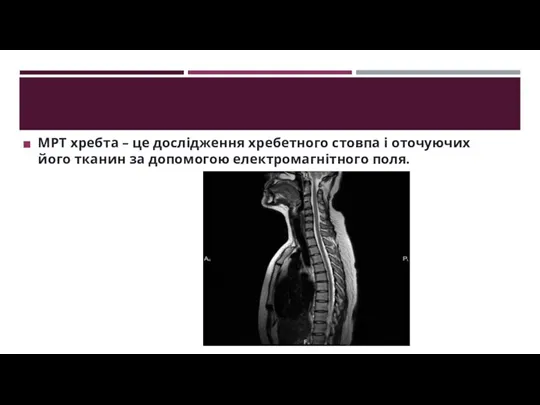 МРТ хребта – це дослідження хребетного стовпа і оточуючих його тканин за допомогою електромагнітного поля.