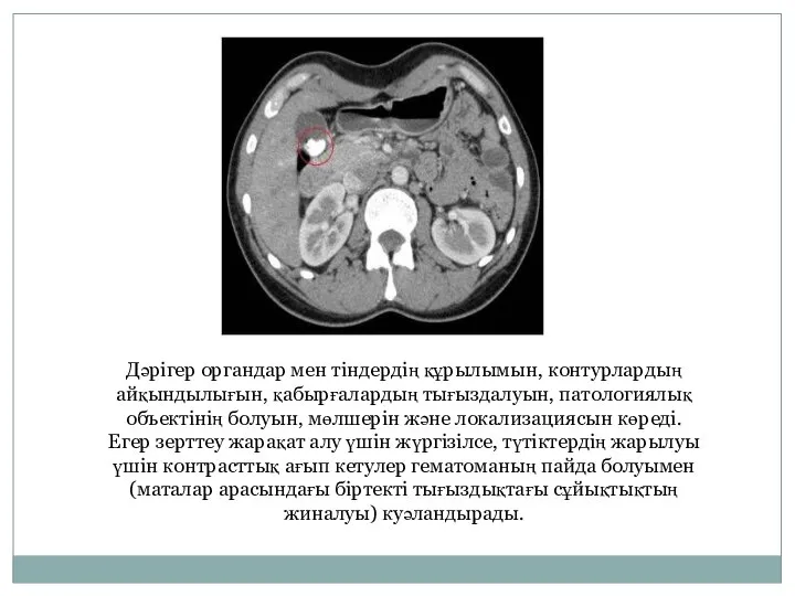 Дәрігер органдар мен тіндердің құрылымын, контурлардың айқындылығын, қабырғалардың тығыздалуын, патологиялық объектінің болуын,