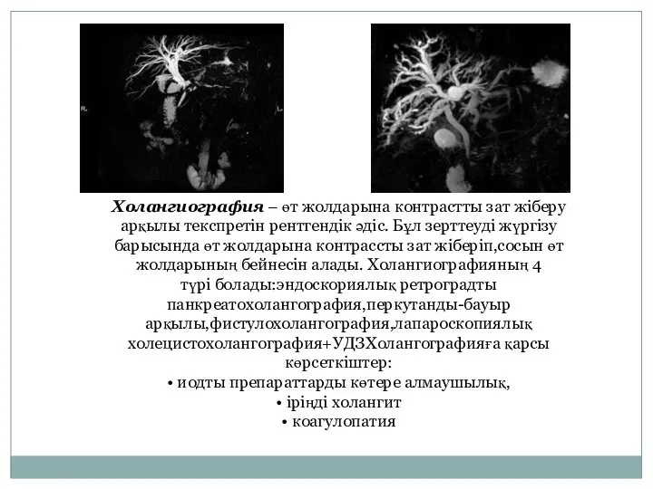 Холангиография – өт жолдарына контрастты зат жіберу арқылы текспретін рентгендік əдіс. Бұл